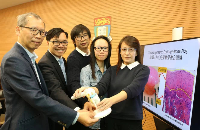 HKU biomedical engineers develop new cartilage regeneration technology to grow cartilage from one’s own cells for cartilage repairs