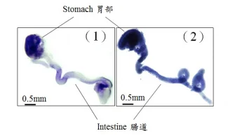HKU Identifies Novel DNA Changes in Patients with Hirschsprung disease that disrupt the development of the enteric nervous system