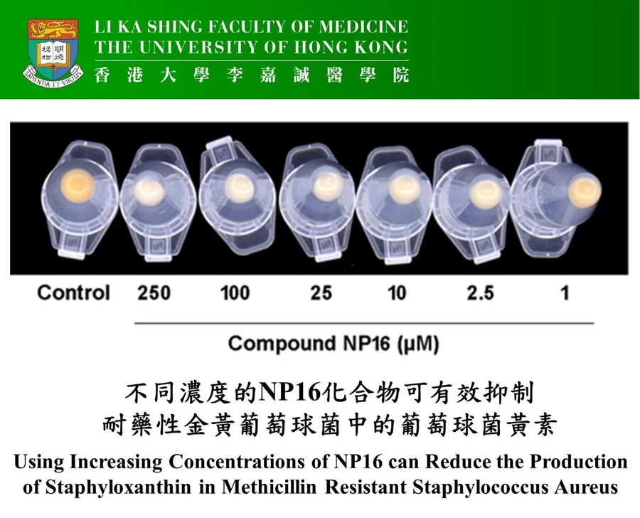Using increasing concentrations of NP16 can reduce the production of staphyloxanthin in methicillin resistant Staphylococcus aureus.