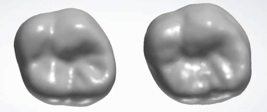 Natural tooth (left) compared with tooth tailored by generative AI  (right)  