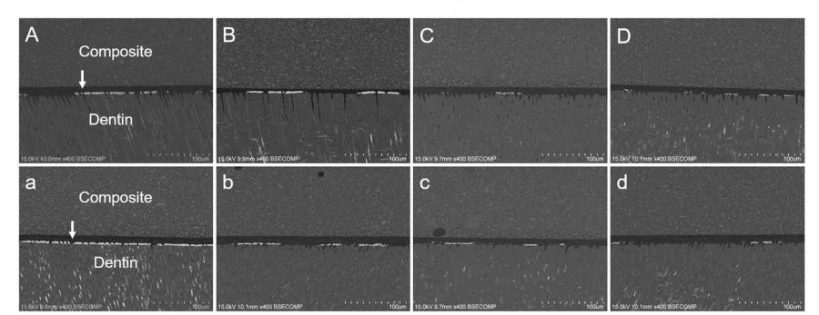 Images of nanoleakage expression from different groups. (A–D) The immediate groups. (a–d) The 10,000 times thermocycling aged groups. The first column is the Control. Groups on the right are treated with increasing concentrations of DMA. In the control group, nanoleakage deposition increased from 36.57% to 50.41% after thermoaging, while no obvious change could be detected for the DMA-treated groups.