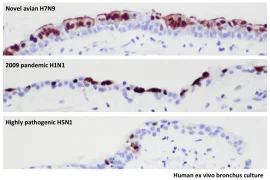 HKU’s finding on avian influenza A (H7N9) virus well adapted to infect human respiratory tract reveals why numerous human infected cases in a short period of time
