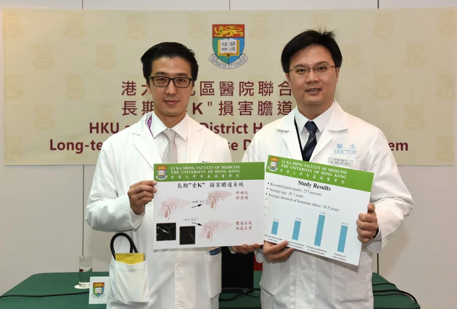 The research team of Department of Medicine, Li Ka Shing Faculty of Medicine, The University of Hong Kong (HKU), and Department of Surgery, North District Hospital (NDH), performed magnetic resonance imaging (MRI) for ketamine abusers and demonstrated ketamine also damages the biliary system. This damage may be reversible after stopping ketamine abuse.
