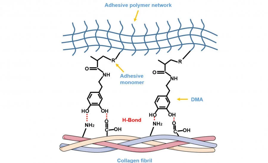 The possible rationale of DMA as a functional monomer in dentin bonding. DMA could be deemed as a “bridge” connecting the upper adhesive network via carbon-carbon double bond polymerization and lower dentin collagen fibrils via hydrogen bond, unifying them as one whole structure