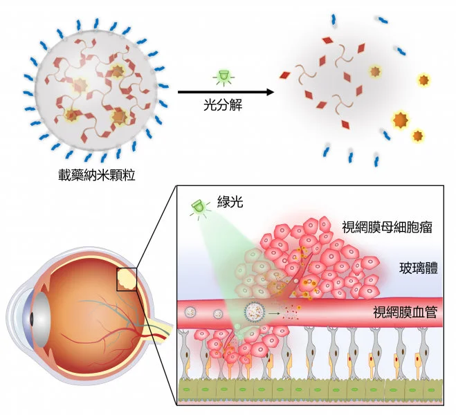 The research team developed a green light-responsive nanocarrier based on the self-assembly of photocleavable three-legged molecules. After intravenous injection of drug-loaded nanocarriers, the light-triggered drug release in retinoblastoma exhibited significant anticancer efficacy and minimal side effects.  