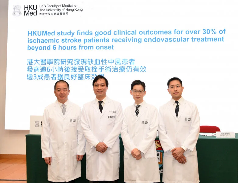 HKUMed research team finds that over 30% of ischaemic stroke patients who received intra-arterial mechanical thrombectomy had a good clinical outcome even after six hours of the onset of symptoms. (From left) Professor Gilberto Leung Ka-kit, Dr Chan Koon-ho, Dr Kevin Cheng King-fai and Dr Edward Chu Yin-lun.  