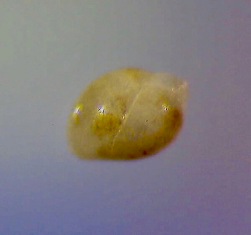Picture of the foraminifer specie used in this study.