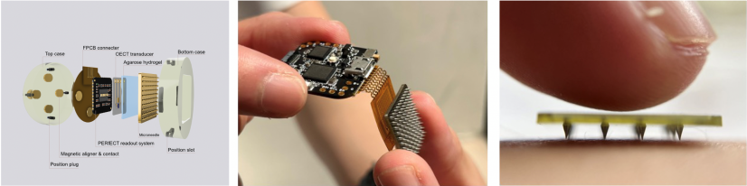 HKU Engineering team develops next-generation wearable continuous glucose monitoring system for diabetes management