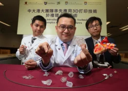 CUHK and HKU Researchers Introduce 3D Printing Technology in Complex Cardiac Surgery Procedures