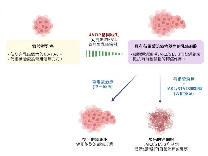 HKUMed discovers a new tumour suppressive gene which boosts personalised treatment response in breast cancer