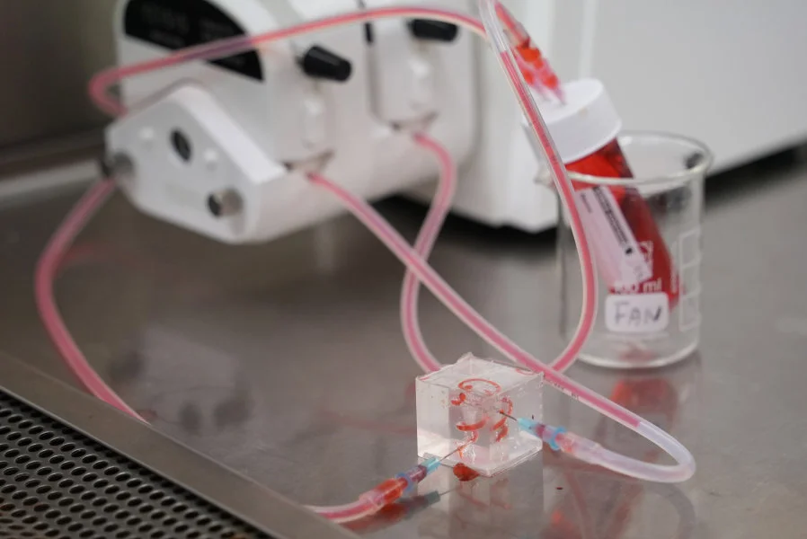 The new drug screening platform ‘Liver-in-Cube’ is developed using cells and tissue from liver cancer patients. The platform accurately simulates the tumour characteristics of individual patients, allowing continuous drug tests and evaluation of the effects of various therapies on the bench.  