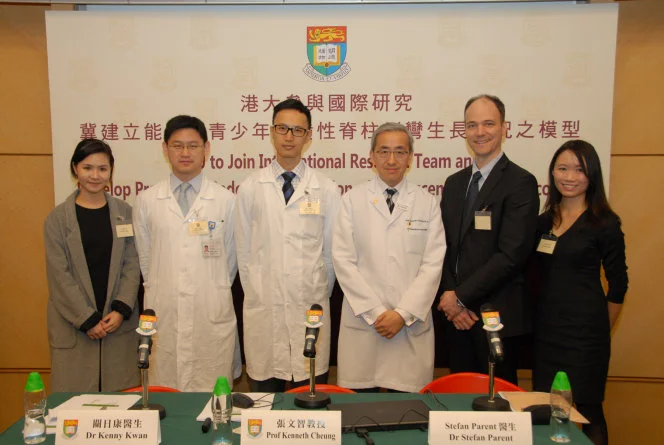 HKU to Join International Collaborative Research Team and Develop a New Predictive Model for Progression of Adolescent Idiopathic Scoliosis