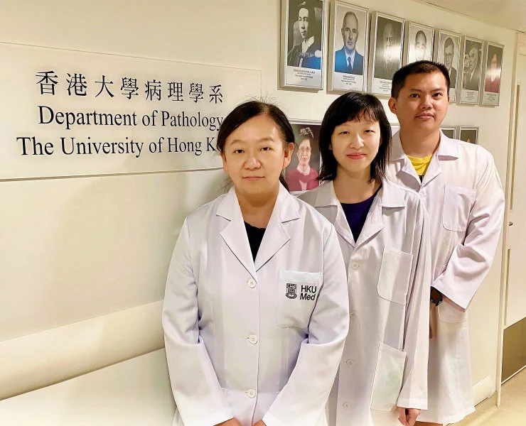 Dr Judy Yam Wai-ping, Associate Professor of the Department of Pathology, HKUMed (left), with her research team members, Dr Tey Sze-keong, Post-doctoral Fellow (right) and Ms Cherlie Yeung Lot-sum, Research Assistant (middle).  