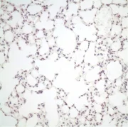 HKU medical research team finds host adaptation strategies of avian influenza A viruses for better replication in human