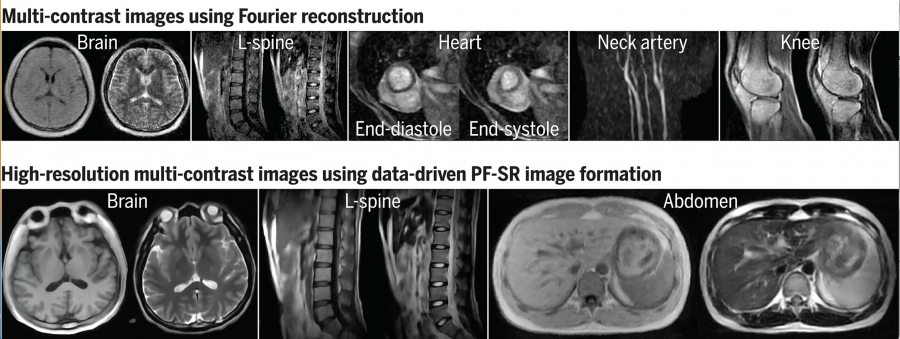 (Top) Typical images of various anatomical structures using conventional image reconstruction  (Bottom) High-resolution images using deep learning image formation by harnessing large-scale high-field MRI data