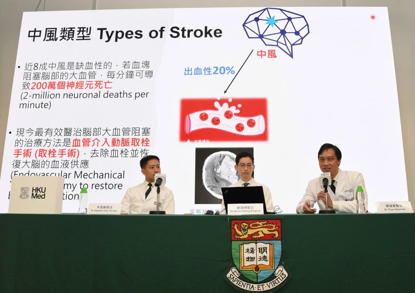 (From right) Dr Chan Koon-ho, Dr Kevin Cheng King-fai and Dr Edward Chu Yin-lun announce the clinical outcomes of their study. Extending the stroke treatment golden period from six hours to 24 hours has shown significant benefits for a larger number of patients.  