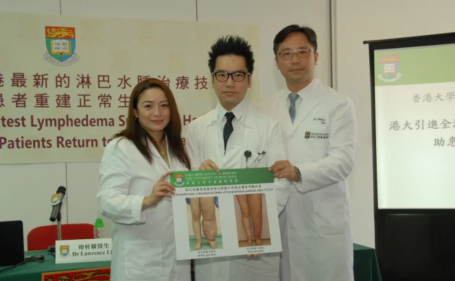 HKU Introduces the Latest Lymphedema Surgery to Hong Kong 
and Helps Patients Return to Normal Life