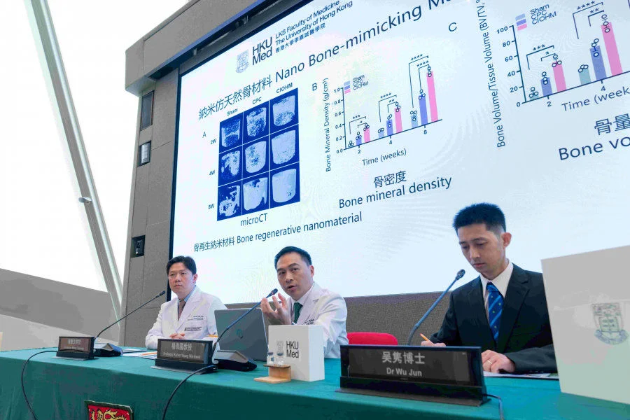 A novel elastic calcium phosphate material developed by HKUMed researchers, offers a promising alternative to traditional bone grafts in orthopaedic surgeries. The research team members include (from left) Professor Wong Tak-man, Professor Kelvin Yeung Wai-kwok and Dr Wu Jun.  