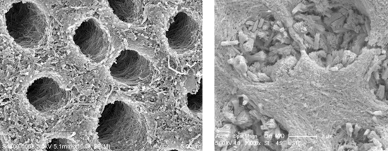 Scanning electron micrographs showing that dentine tubules (left) were filled with crystals after polydopamine-based remineralisation (right).