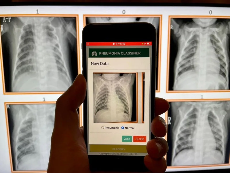 Students are engaged in exercises, using an App developed by HKUMed and their own smartphones to detect and differentiate patients’ chest x-rays with and without pneumonia, such that they could better understand the principles of data labelling and machine learning.  