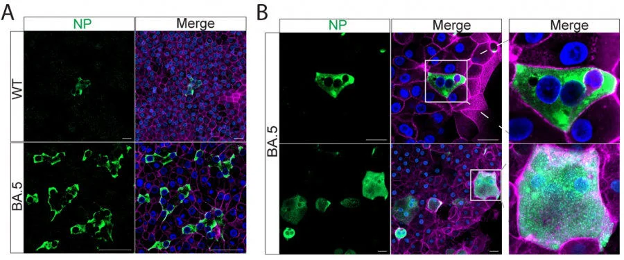 Nasal organoids were inoculated with SARS-CoV-2 WT and BA.5 at 0.01 MOI. Virus-infected (Nucleocapsid, NP+) cells in BA.5-infected nasal organoids were remarkably more abundant than those in WT-infected organoids (Diagram A). NP+ multi-nucleated syncytia with typical morphology were readily discernible in BA.5-infected monolayers of the nasal organoids (Diagram B).   