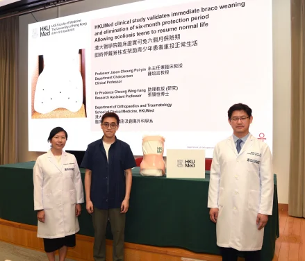 HKUMed clinical study validates immediate brace weaning and elimination of six-month protection period 
allowing scoliosis teens to resume normal life