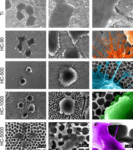 - Material surface morphologies of different samples under scanning electron microscope examination, including flat Ti, nano-structure in 90nm, 500nm, 1000nm and 5000nm    - Cellular morphologies of macrophages on different sample surface (scale bars, 10 μm (first column), 5 μm (second column) and 1 μm (third column))    -  The cells on 90nm surface extended more “legs” (filopodia) than those on 500nm, 1000nm and 5000nm.