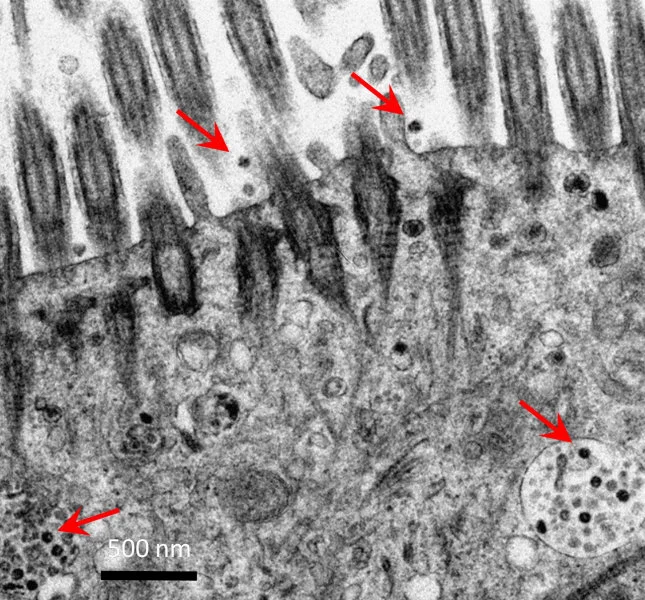 Electron micrograph of the human bronchus tissues after infection with SARS-CoV-2. Red arrows showing viral particles.     