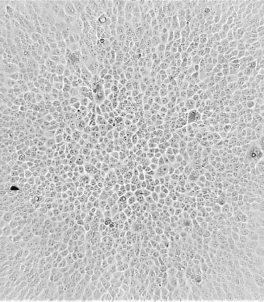 Cells are protected from killing by Ancestral SARS-CoV-2 after addition of serum from individuals vaccinated by Coronavac.