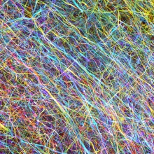 HKU and Imperial College London co-developed novel techniques for 
three-dimensional visualisation of microscopic structures in the human brain