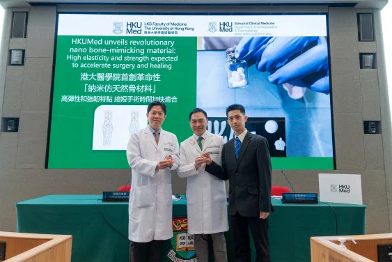 HKUMed unveils revolutionary nano bone material: 
High elasticity and strength expected to accelerate surgery and healing