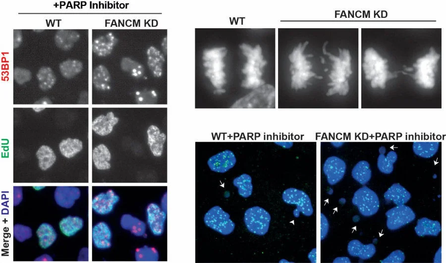 Image 1. Inactivation of a DNA repair gene called FANCM enhances the formation of DNA damage and chromosomal instability induced by a PARP inhibitor, leading to massive cancer cell death. Image modified from Liu et al, Cell Reports (2024).  
