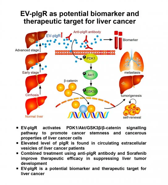 HKUMed researchers identified a key molecule in extracellular vesicles of liver cancer patient as a potential new biomarker  for early diagnosis and therapeutic target  