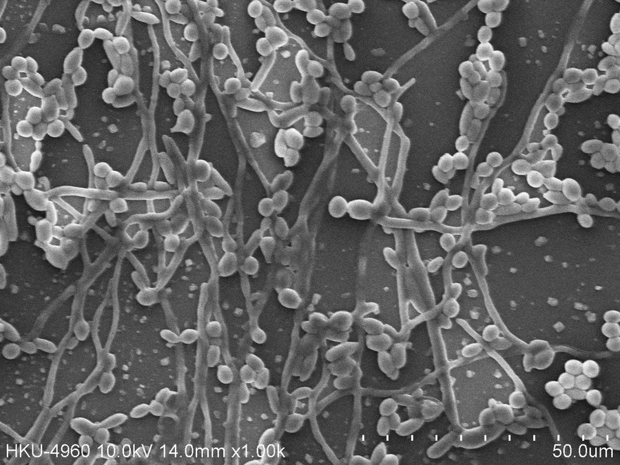 HKU-led study finds natural food dye can stop fungus in its tracks