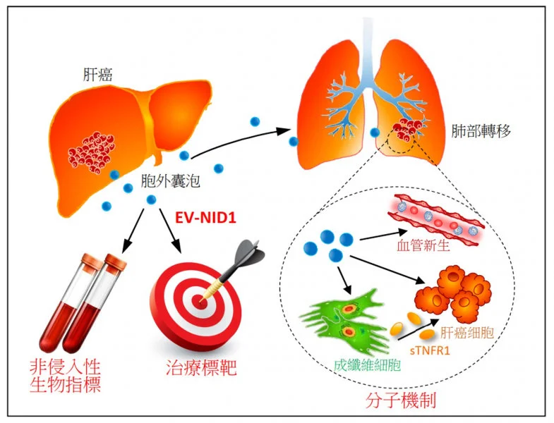 A research team at LKS Faculty of Medicine, The University of Hong Kong (HKUMed) discovered that the liver cancer cell-derived extracellular vesicles (EVs) promote tumour growth and metastasis to lungs. The novel findings of the tumour-derived extracellular vesicles provide insights into promising biomarker and new therapeutic approach for liver cancer.  