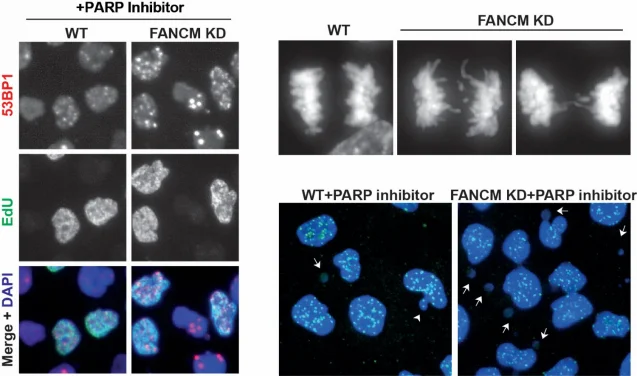 HKU Researchers Shed Light on Overcoming Cancer Drug Resistance
Unlocking Potential to Expand Use of PARP Inhibitors Across Cancer Types