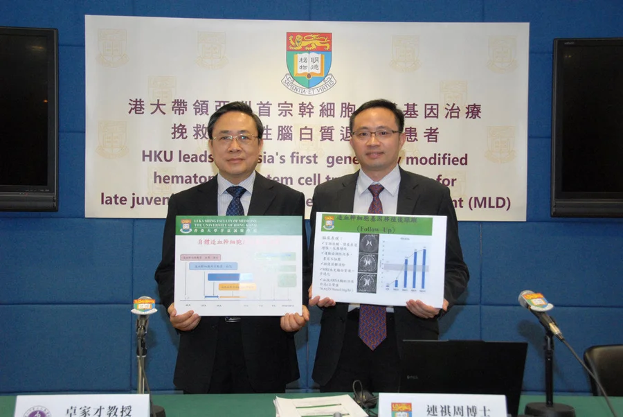 A stem cell research team at the Li Ka Shing Faculty of Medicine, The University of Hong Kong (HKU) has led the first genetically modified hematopoietic stem cell transplantation in Asia for a Taiwanese juvenile with the fatal inherited disorder metachromatic leukodystrophy (MLD), through close collaboration with researchers from The Second People’s Hospital of Shenzhen (The First Affiliated Hospital of Shenzhen University), Mainland China, and the National Taiwan University Hospital (NTUH), Taiwan. (From left) Professor Zhuo Jiacai, Clinical Professor and Head of the Division of Haematology at the Second People’s Hospital of Shenzhen (The First Affiliated Hospital of Shenzhen University) and Dr Lian Qizhou, Assistant Professor of the Department of Ophthalmology and Department of Medicine of Li Ka Shing Faculty of Medicine, HKU attended the press conference.