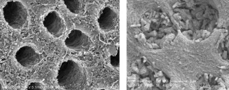 Dental researchers at HKU and Anhui Medical University apply mussel power to fortify teeth