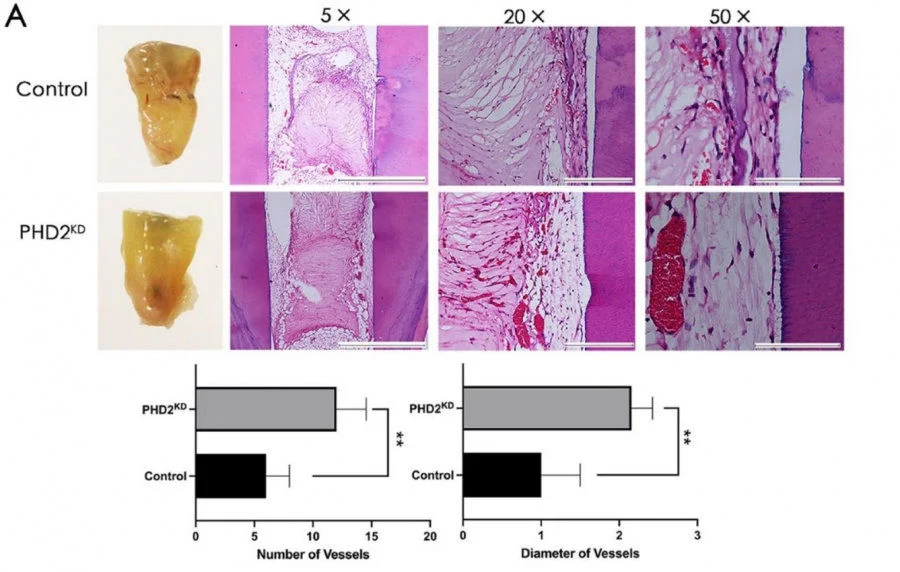 Tooth stem cells modified to mimic a cellular state similar to that under low oxygen (PHD2KD) gave rise to tooth pulp tissue with a significantly increased amount of blood vessels.  