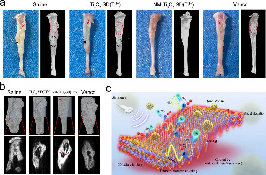 Treatment efficacy: Animal models with bone tissue infection:  a) Macroscopic images of infected tibia specimens of mice after 14 days of different treatments. With the use of NM-Ti3C2-SD(Ti3+) nano-sheets (NM-nano-sheets), bony tissue infection has been controlled and no deformity of bone has been found.  b) Three-dimensional reconstruction CT images (top, indicated by the light blue areas) and the μ-CT 2D images of the corresponding sections (bottom) of harvested bone tissues. The bone tissue treated by NM-nano-sheets was completely healed. After 14 days of treatment, new bone tissue has formed at the defect area (indicated by red arrow).  c) Schematic diagram of NM-nano-sheets releasing reactive oxygen species (1O2) and tracking MRSA bacteria.