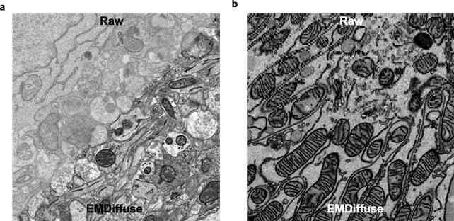 (a) EMDiffuse removes noise and restores ultrastructure information from noisy electron microscope images; (b) EMDiffuse enhances the axial resolution of volume electron microscope data. Image modified from Lu et al, Nature Communications (2024).