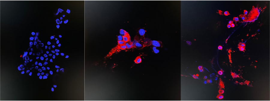 Immunofluorescence staining of uninfected and infected Vero E6 cells left: Uninfected sample (the negative control) middle: 24 hours post infection right: 48 hours post infection (see red fluorescent cytoplasmic antigen staining under confocal microscopy)    Photo credit: Department of Microbiology, HKU   