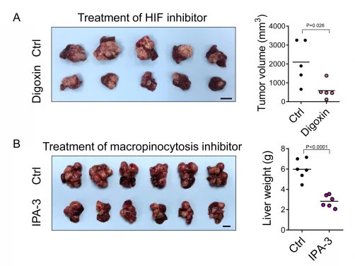 HKUMed discovers a new metabolic route for liver cancer
paving the way for new therapeutic opportunities