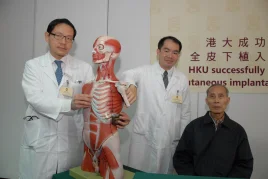 HKU successfully performs the first implant of 
a subcutaneous implantable cardioverter defibrillator in Asia