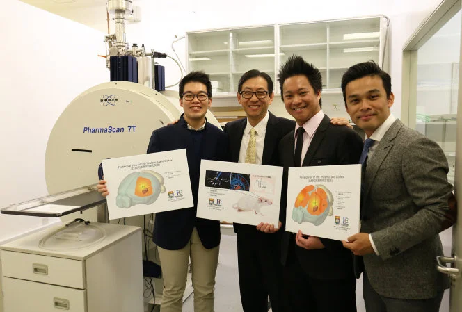 HKU scientists utilise innovative neuroimaging approach 
to unravel complex brain networks
