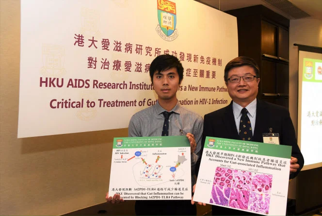 HKU AIDS Research Institute Discovers a New Immune Pathway 
Critical to Treatment of Gut Inflammation in HIV-1 Infection