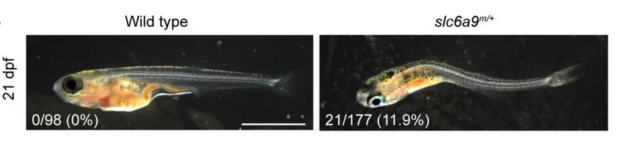 In HKUMed study, the mutant zebrafish exhibited spinal curvature and discoordination of spinal neural activity, resembling the symptoms found in AIS patients. This finding suggests that SLC6A9 is the main cause of AIS.  