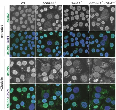 HKU Biologists Reveal a Molecular Scissor that Cuts Chromatin Bridge and Prevents DNA Damages and Autoimmunity