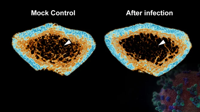 HKUMed researchers discover that SARS-CoV-2 infection induces severe inflammatory bone loss in Syrian hamsters