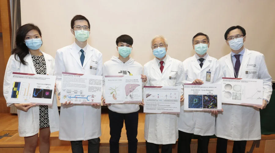 HKUMed discovered beta-amyloid deposition to be a novel disease mechanism for Biliary Atresia (from left: Dr Michelle Yu On-na, Dr Patrick Chung Ho-yu, patient Wong Cheuk-nam, Professor Paul Tam Kwong-hang, Dr Vincent Lui Chi-hang and Dr Kenneth Wong Kak-yuen).  